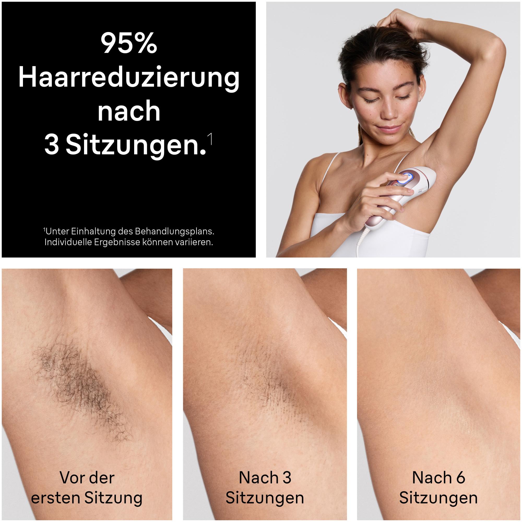 BRAUN Smart IPL Skin i·expert IPL Haarentferner