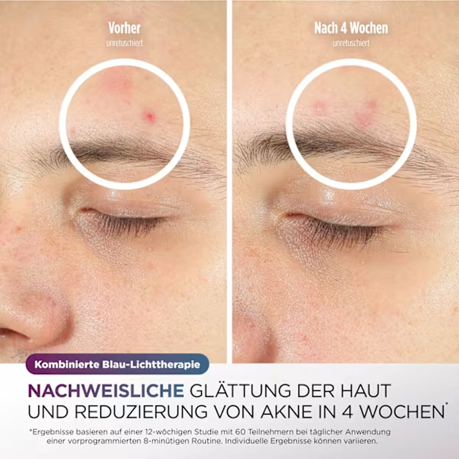 Shark FW312EUPL CyroGlow Gesichtspflege