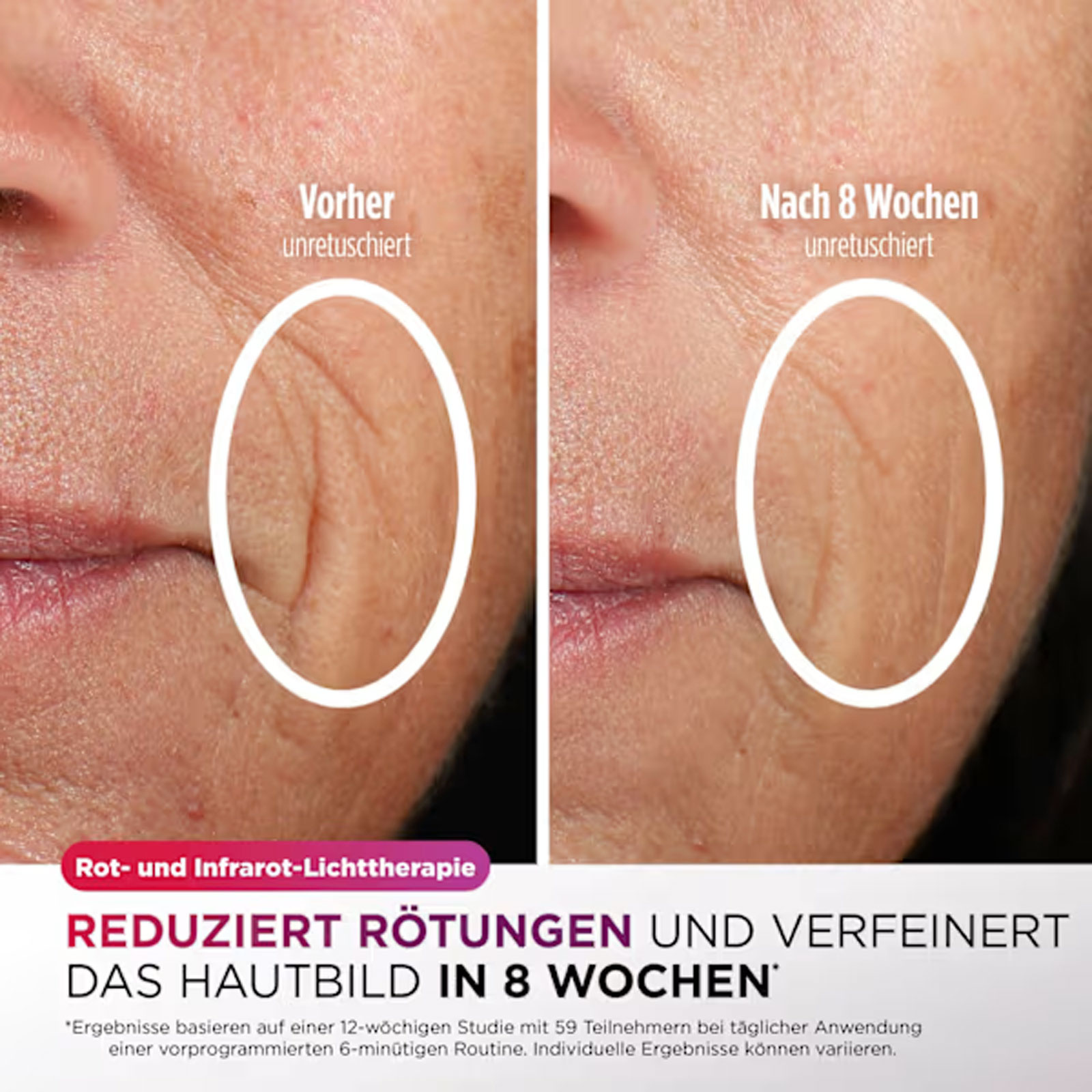 Shark FW312EUPL CyroGlow Gesichtspflege