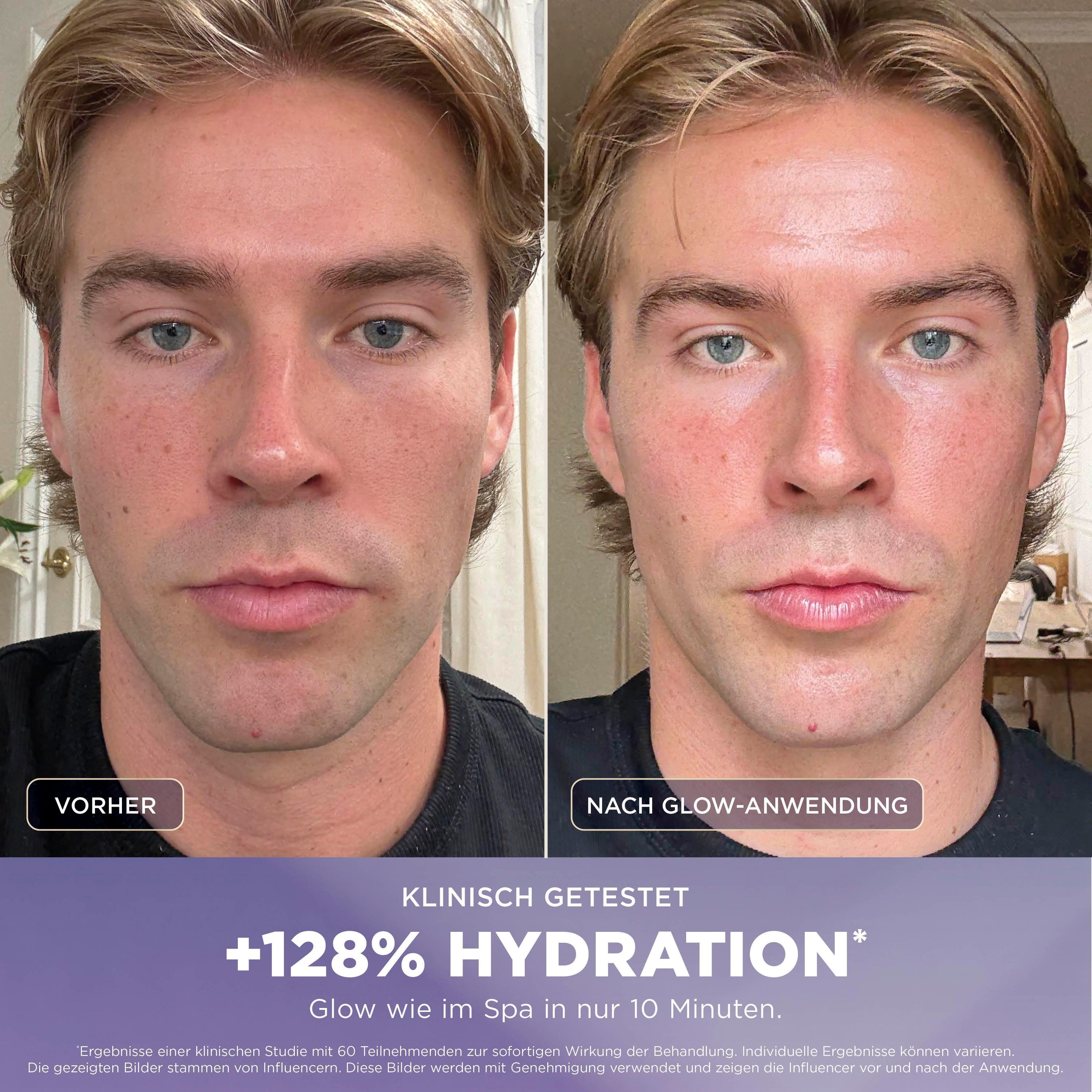 Shark FacialPro Glow Hydro Gesichtspflegesystem für zuhause FH320EU - Blau